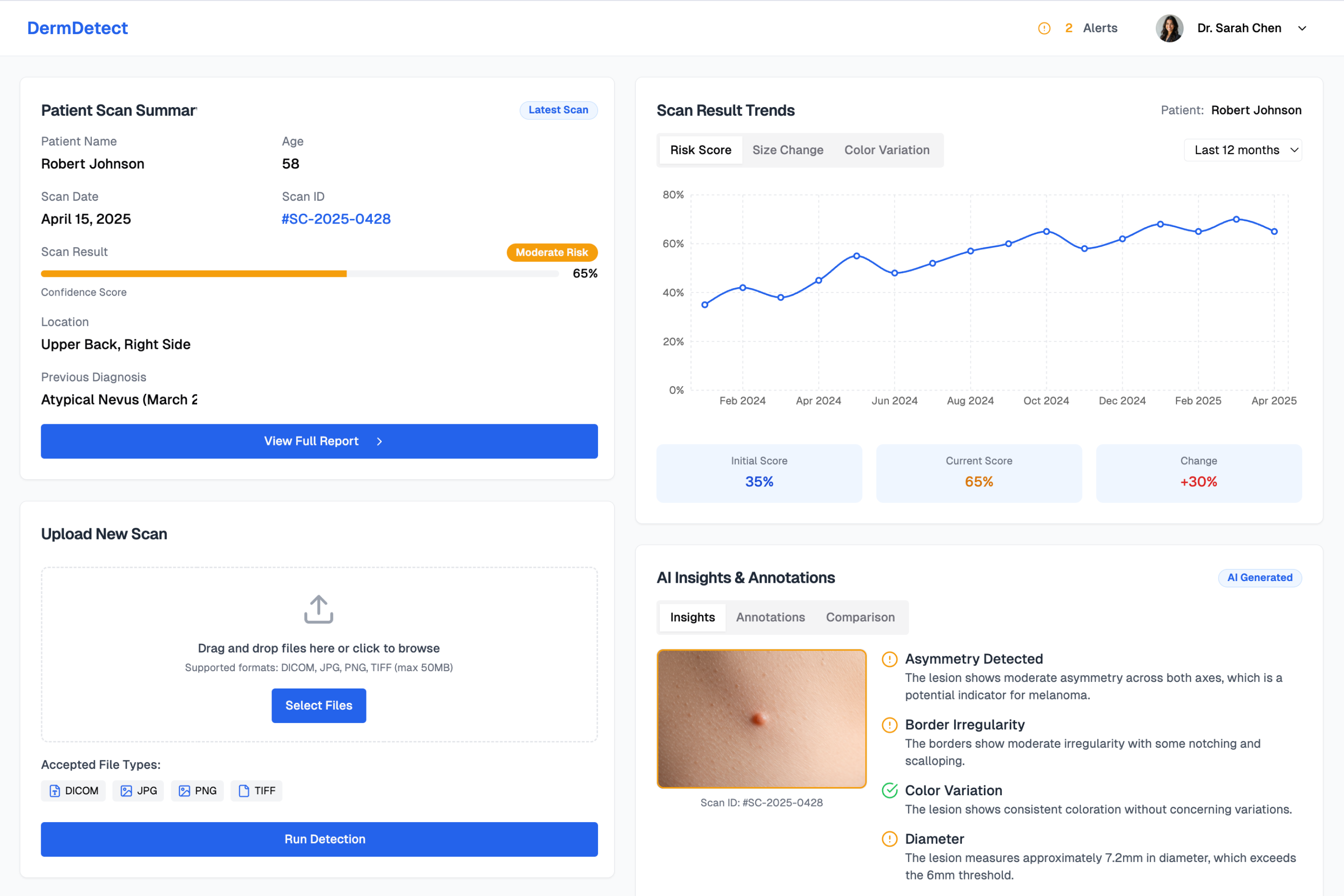 DermDetect skin cancer detection dashboard showing patient scan results and AI insights